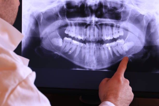 Best Emergency Gum Treatment in Carnegie, OK